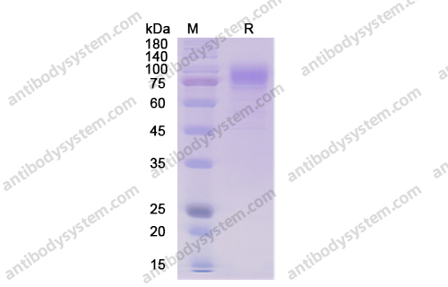Recombinant Human CD36, C-His