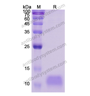 Recombinant Human NPPB, N-His