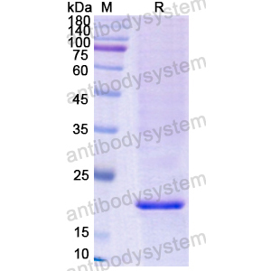 Recombinant Human CPE, N-His