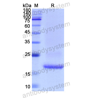 Recombinant Human STMN1, N-His