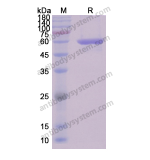 Recombinant Human DES/Desmin, N-His