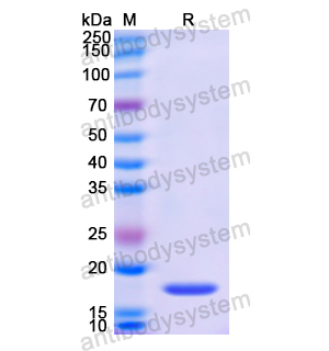 Recombinant Human CEBPB, N-His