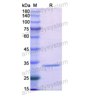 Recombinant Human PTPN2, N-His