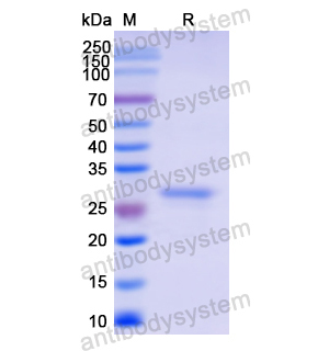 Recombinant Human LGALS3, C-His