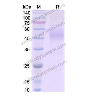 Recombinant Human FLT1, C-His