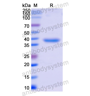 Recombinant Human PTPN1, N-His