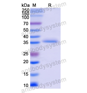 Recombinant Human ALOX12, N-His
