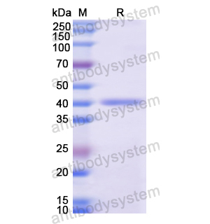Recombinant Human XRCC1, N-His