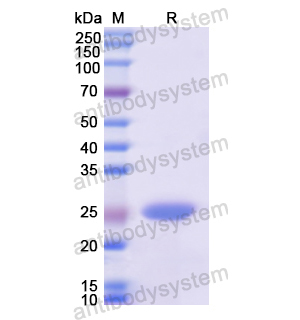 Recombinant Human KRT15, N-His