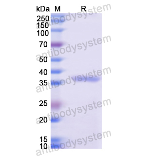 Recombinant Human KRT4, N-His