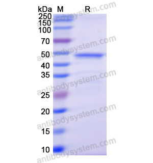 Recombinant Human HDC, C-His