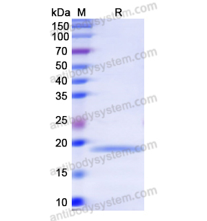 Recombinant Human TNNI1, N-His