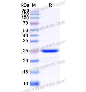Recombinant Human TNNI3, N-His