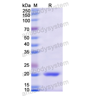 Recombinant Human CD224/GGT1, N-His