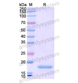 Recombinant Human WT1, N-His