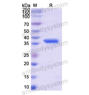 Recombinant Human ITIH1, N-His