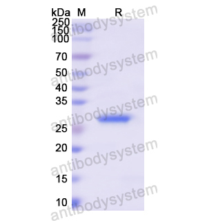 Recombinant Human CEL, N-His