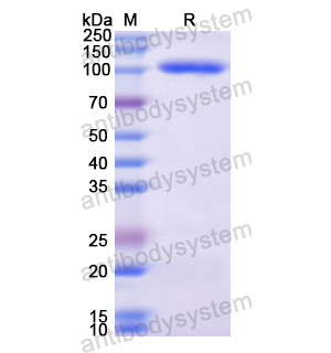 Recombinant Human NFKB1, N-His