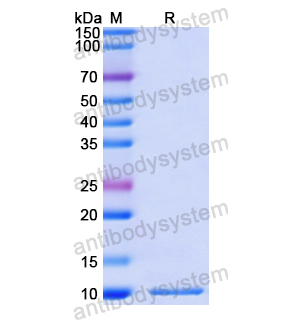 Recombinant Human CXCL3/GRO-gamma/MIP2-beta, N-His
