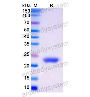 Recombinant Human NCF2, N-His