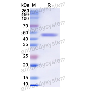 Recombinant Human TCN1, N-His