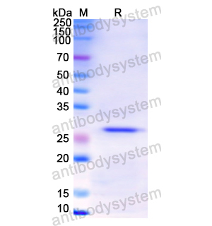 Recombinant Human CD120b/TNFRSF1B/TNFR2, N-His