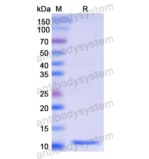 Recombinant Human RAB5A, N-His