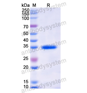 Recombinant Human MX1, N-His