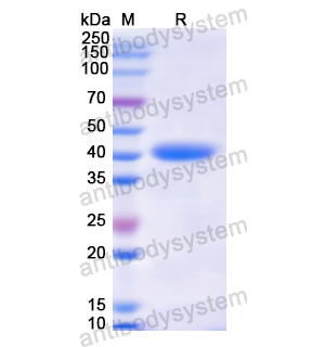 Recombinant Human H2AC7, N-GST