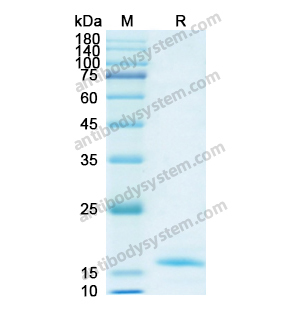Recombinant Human LMNB1, N-His