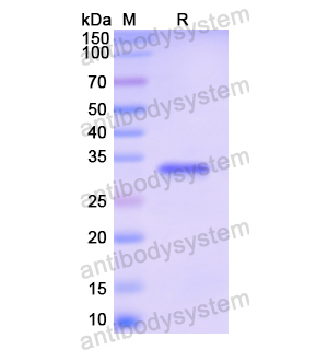 Recombinant Human CD11a/ITGAL, N-His