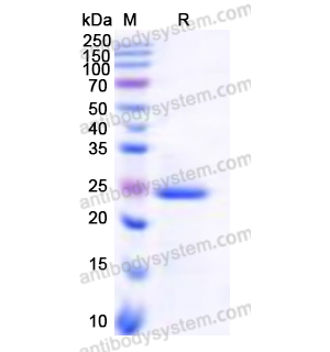 Recombinant Human DDC, N-His
