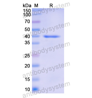 Recombinant Human PZP, N-His