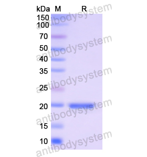 Recombinant Human EDN2, N-His