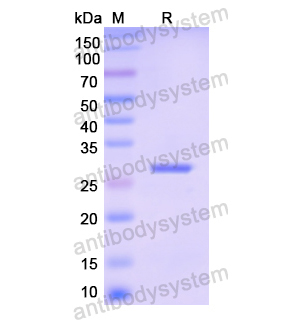 Recombinant Human CAPN3, N-His