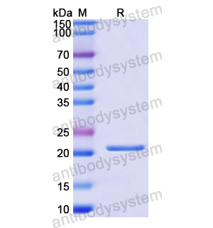 Recombinant Human IL11, N-His