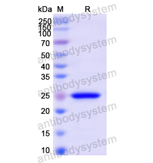 Recombinant Human AGA, N-His