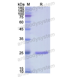 Recombinant Human RASA1, N-His