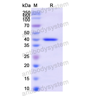 Recombinant Human CD247/CD3Z, N-GST