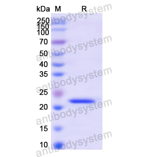 Recombinant Human CSRP1, N-His