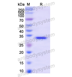 Recombinant Human FLNA, N-His