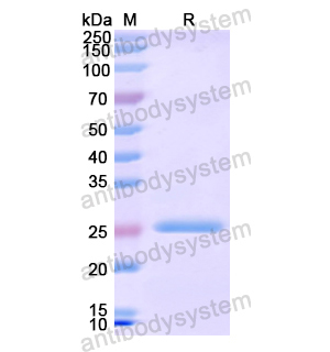 Recombinant Human ACO1, N-His
