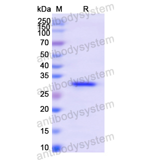 Recombinant Human ABCB4, N-His