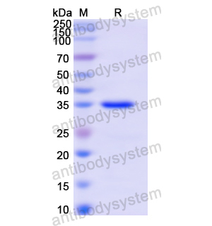 Recombinant Human FPR1, N-GST