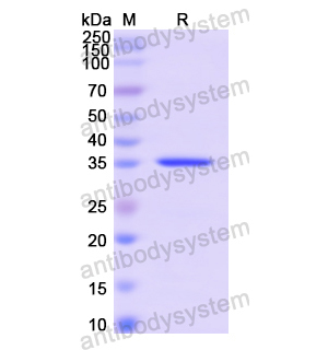 Recombinant Human SYT1, N-His