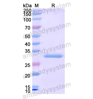 Recombinant Human EPHA1, N-His