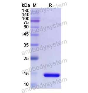 Recombinant Human DRD1, N-His