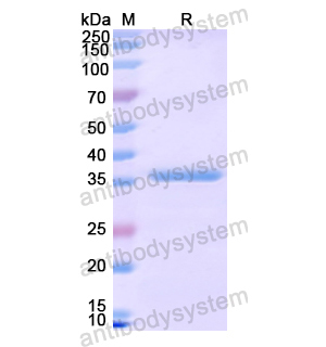 Recombinant Human TBXA2R, N-His