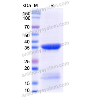 Recombinant Human VDAC1, N-His