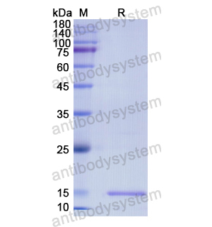 Recombinant Human DRD5, N-His